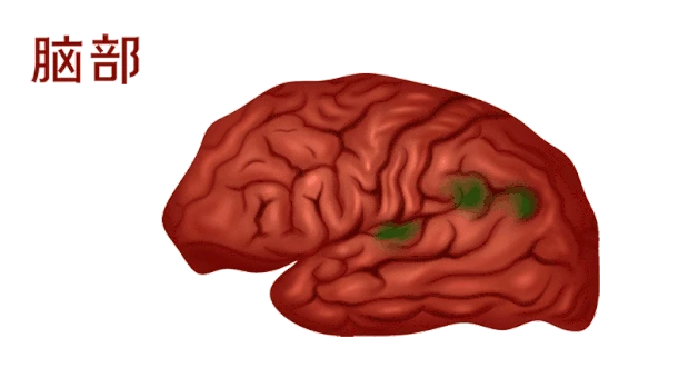 医疗大脑脑部脑人体器官 gif图素材