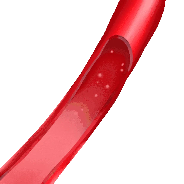 医疗血管堵塞心血管疾病血红蛋白血栓红色gif图素材
