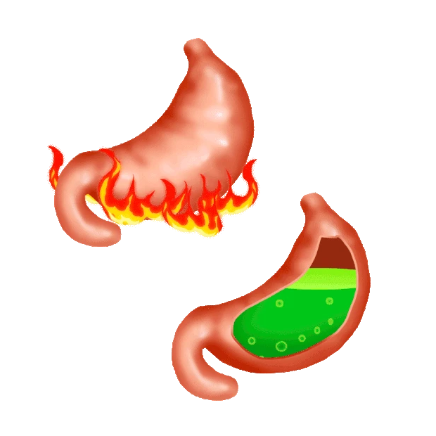 胃部胃酸胃热膨胀燃烧燃烧气泡gif图素材